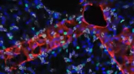 Perl Lab Research | Pulmonary Biology