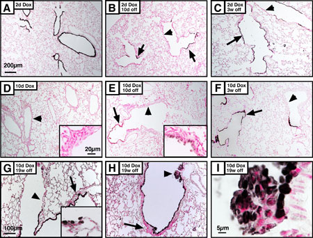 Chronic loss and aberrant repair of Clara cells after continuous DT-A expression.
