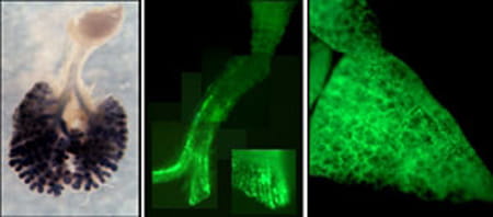 Lungs of triple transgenic mice.