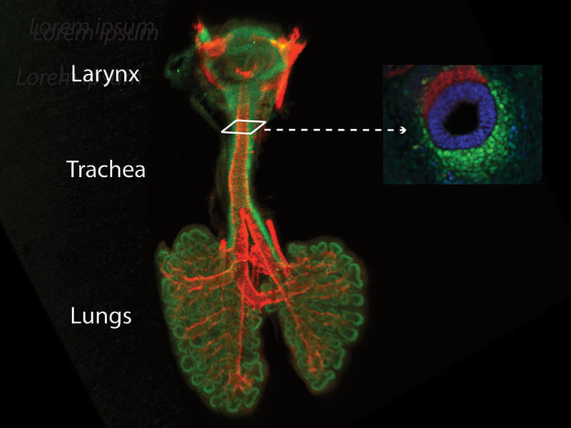 Epithelium and mesenchyme.