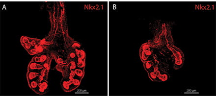 Pulmonary left-right asymmetry.