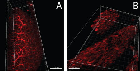 The developing pulmonary vasculature was labeled with tomato (Lycopersicon esculentum) lectin injected into umbilical vessels of E18.5 mice. Confocal-aided z stacking of images and 3D reconstruction revealed patterning of the developing pulmonary microvasculature. The anomalous distal vasculature in WlsShhCre consisted of dilated vessels (B), as opposed to the stereotypical microvasculature present in control embryos (A).