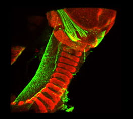 Immunofluorescence staining of a mouse embryo cross section depicts the normal dorsal ventral patterning of the supporting structures of the trachea. Deviations to this pattern result in conditions such as tracheomalacia and complete tracheal rings. Sox9 staining identifies the region where cartilage will develop. SMA stained cells will give rise to trachealis muscle.