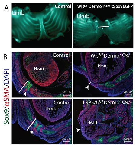 (A) Whole mount images of genetically labeled cartilage show the normal arrangement of ribs and sternum of a developing mouse embryo. Deletion of Wls in developing mesenchyme results in lack of fusion of the sternum (line segment). (B) Images of cross sections at the level of the heart depicting the thoracic body wall are shown (arrowheads). The thickness of the thoracic body wall is reduced after deletion of Wls or Lrp5 and Lrp6 in developing mensenchyme (compare line segments).