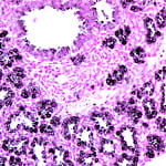 Epithelial Cell Patterning and Differentiation.