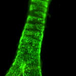 Lung Progenitor / Stem Cells.