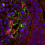 Lung Specific Gene Regulation and Transcription Factors.