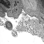 Surfactant Regulation and Biology.