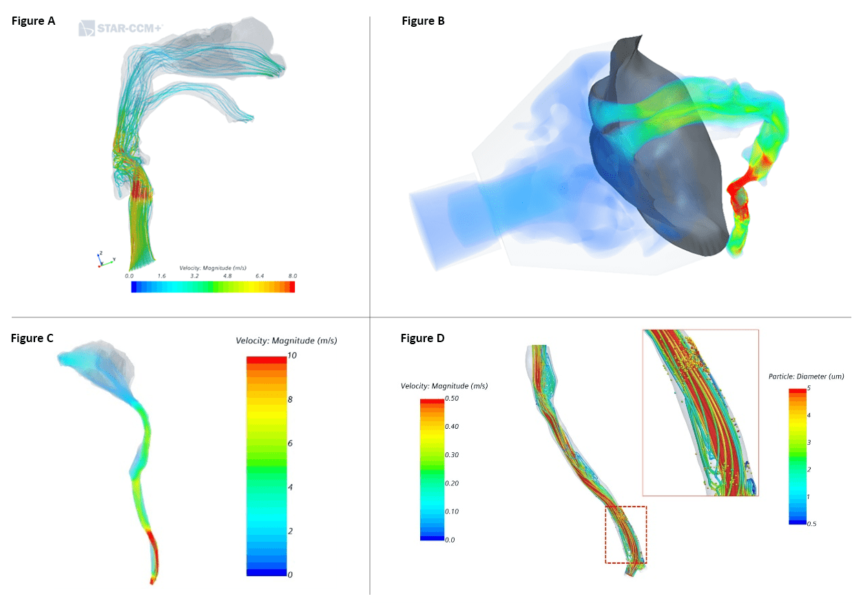 Diagrams showing path and velocity of airflows.