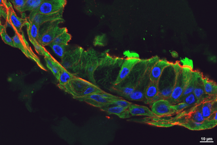 Immunofluorescence image of a nasal cell organoid in partial cross-section.