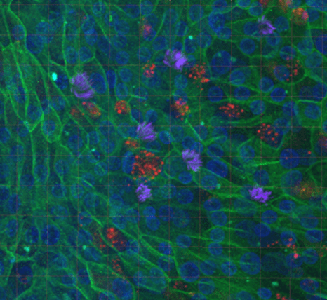 Immunofluorescence image of a nasal cell air-liquid interface culture.