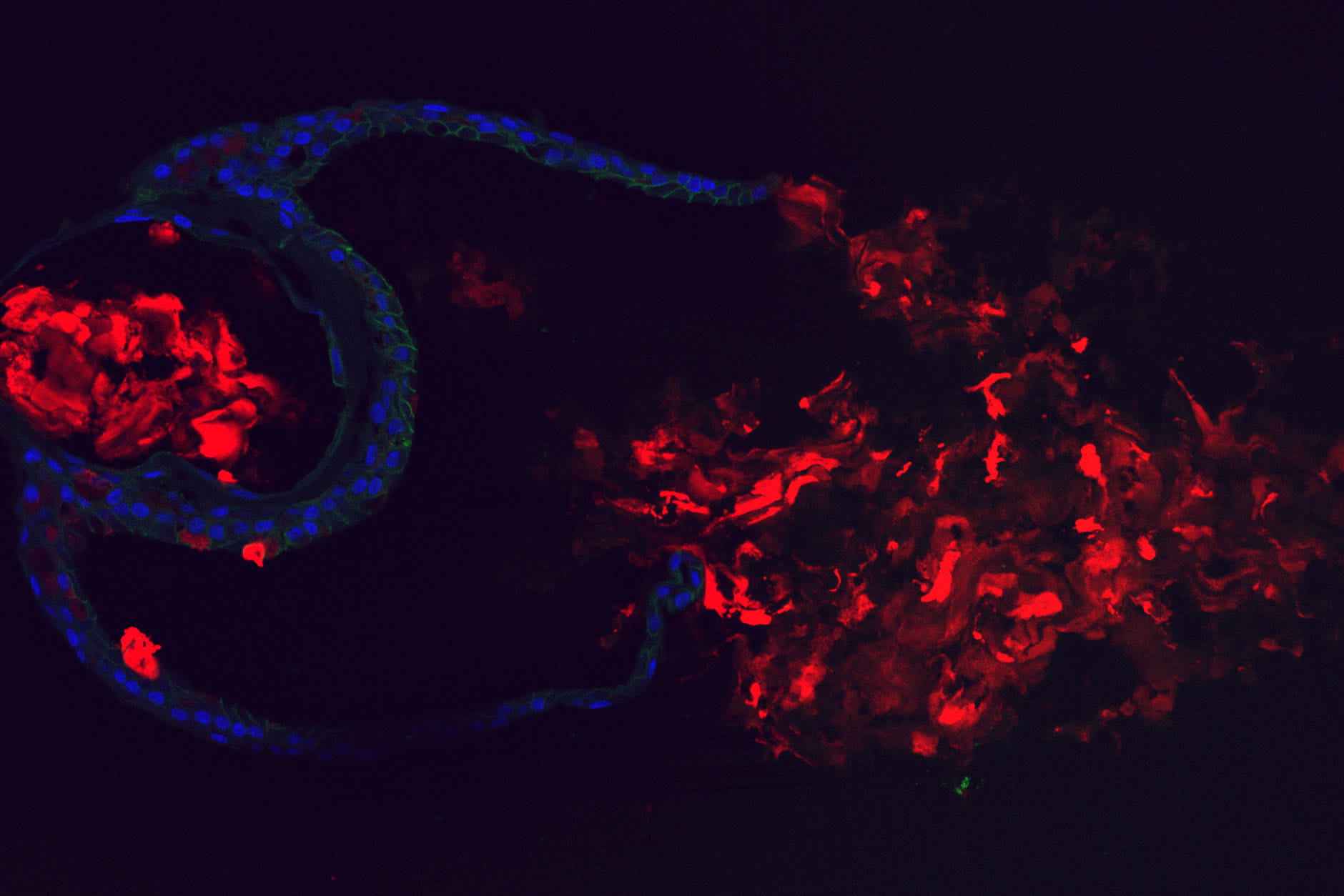 Immunofluorescence image of a nasal cell-based organoid in cross-section.