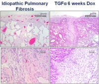 Hematoxylin and eosin stain.