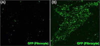 Green florescent protein.