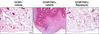 Hematoxylin and eosin stain on lung sections from mice overexpressing TGFa.