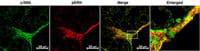 Representative photomicrographs of lung plural regions from TGFα mice.