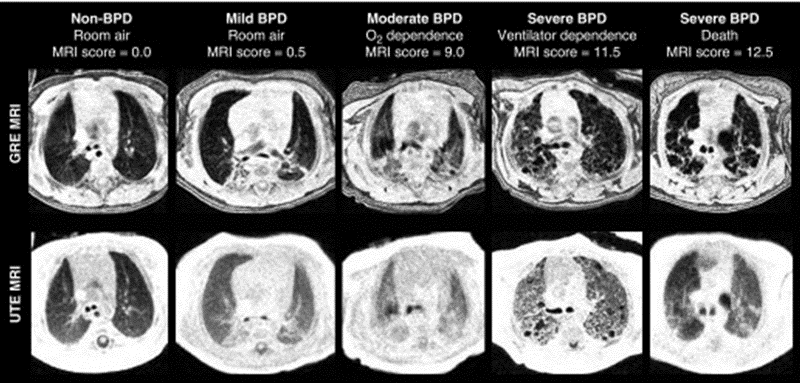 Representative axial gradient echo.