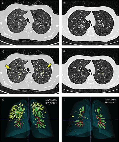 Artificial Intelligence.