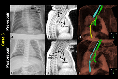 Neonatal MRI.