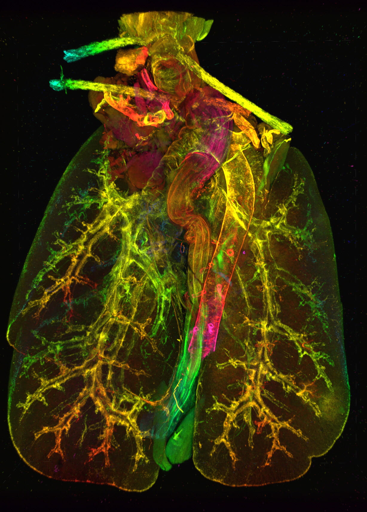 Image of depth code of a lung.