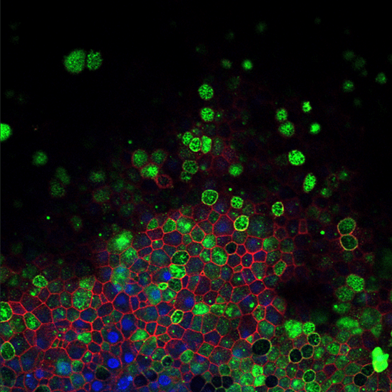 Fluorescent histology of nasal epithelial cells.