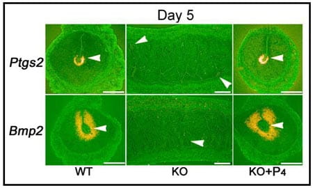 Location of blastocysts.