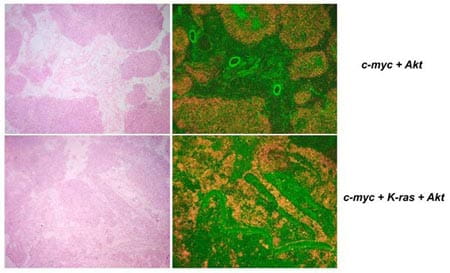 Cox-1 is preferentially expressed in oncogene-induced mouse epithelial ovarian cancer.