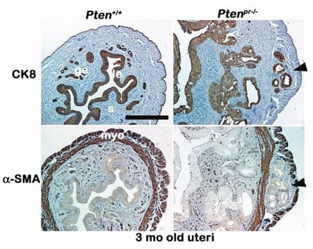 reproductive-visual2-450-endometrial