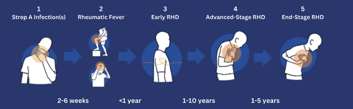 The progression of RHD.