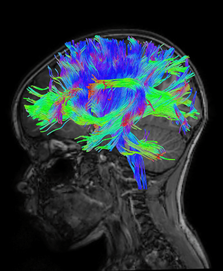 A brain using advanced equipment from the Imaging Research Center.