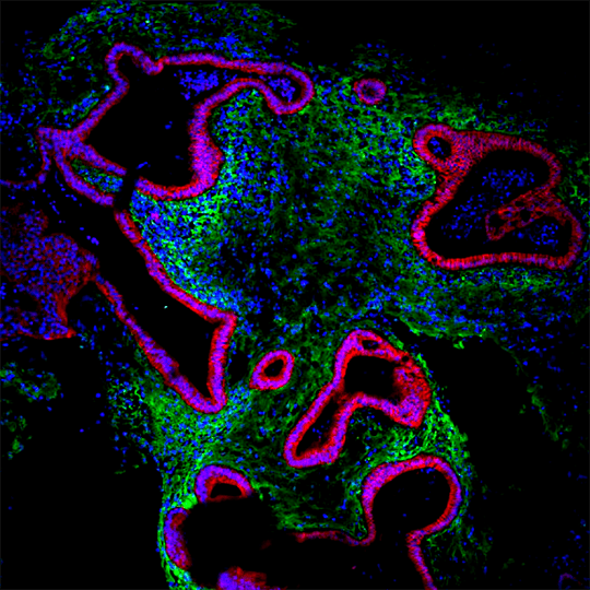hPSC-derived small intestinal organoid.
