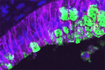 An hPSC-derived stomach organoid.