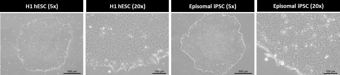 View cells cultured in feeder-free culture conditions for 15 passages.