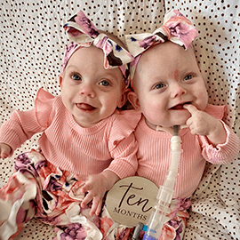 Twins smile together.