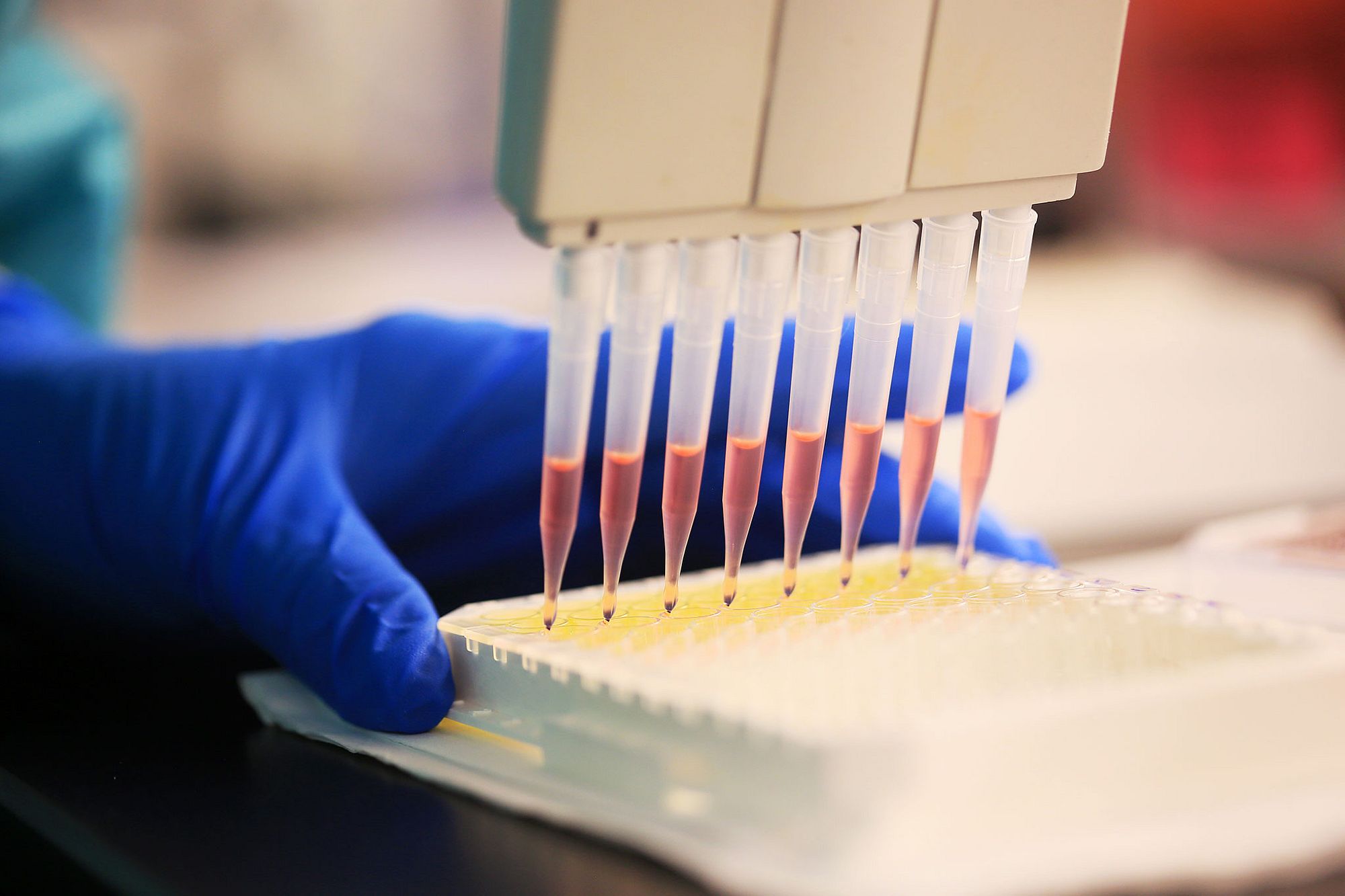Photo of Hemostasis & Thrombosis laboratory.