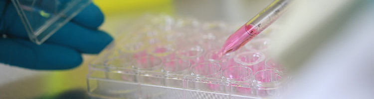 The Cancer & Blood Disease Institute’s Clinical Laboratories provide testing to aid in the detection, diagnosis and treatment of pediatric and adult oncologic, hematologic and immunologic disorders.