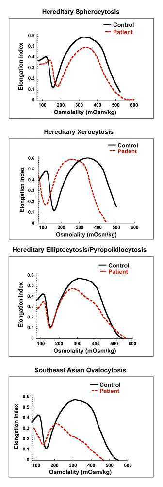 Examples of RBC membrane disorders detected by ektacytometry.