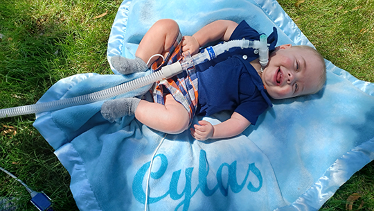 Tom Clarkin Meet Cylas | CDH Patient Stories