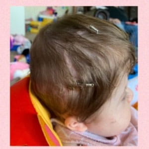 Aria side view, phase 4.