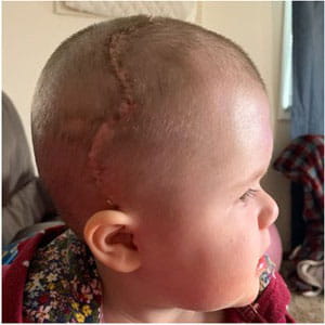 Aria side view, phase 2.