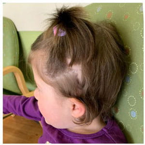 Aria side view, phase 5.