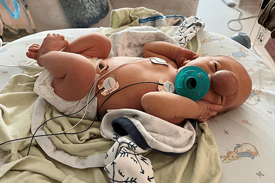 Liam in NICU before surgery.