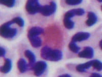 Eosinophil image