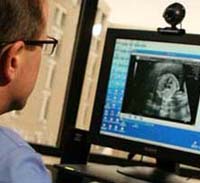 A cardiologist reviews a sonogram.