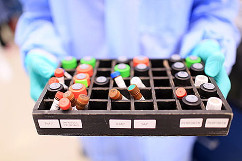 The Diagnostic Center for Heritable Immunodeficiencies (DCHI) at Cincinnati Children’s is the largest and most specialized center in North America for the diagnosis of rare primary immunodeficiencies, bone marrow failure syndromes and other disorders of the immune system. 