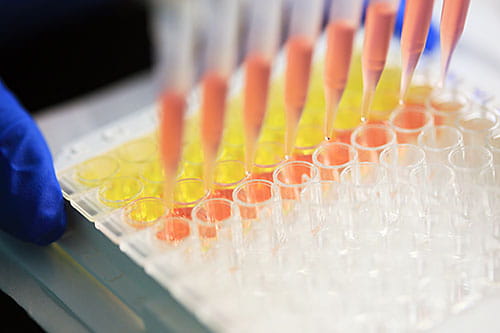 The Diagnostic Center for Heritable Immunodeficiencies (DCHI) at Cincinnati Children’s is the largest and most specialized center in North America for the diagnosis of rare primary immunodeficiencies, bone marrow failure syndromes and other disorders of the immune system. 