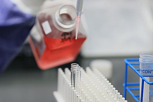 The Diagnostic Center for Heritable Immunodeficiencies (DCHI) at Cincinnati Children’s is the largest and most specialized center in North America for the diagnosis of rare primary immunodeficiencies, bone marrow failure syndromes and other disorders of the immune system. 