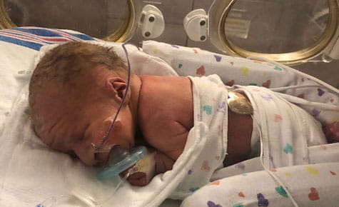 Baby Anna in the Newborn Intensive Care Unit (NICU).