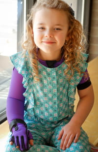 A patient from the Hemangioma and Vascular Malformation Center.