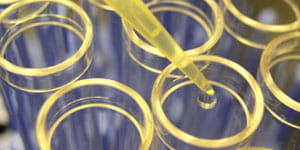 The Diagnostic Immunology Laboratory at Cincinnati Children's.